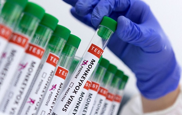 Franca confirma primeiro caso de Monkeypox;  paciente é homem de 28 anos 