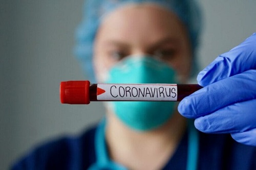 Covid-19: Franca registra 598 infectados, 14 mortes e 212 curados 