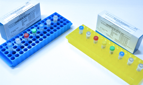 Fiocruz desenvolve kits para diagnóstico laboratorial do novo coronavírus