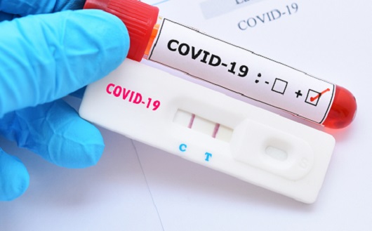 Após 6 meses de pandemia, Franca inicia testagem em massa para casos Covid-19
