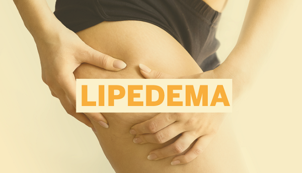 Lipedema: mais de 10 milhões de brasileiras podem ter a doença e não sabem