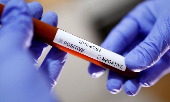Vigilância confirma mais de 4 mil infectados por coronavírus em Franca