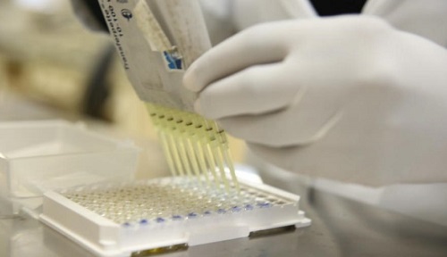 SP mira 30 mil testes diários de coronavírus com inclusão de exames privados