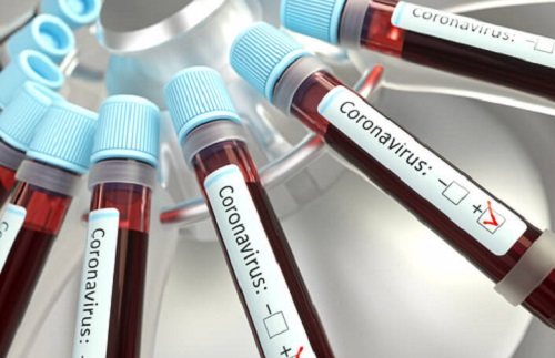 Covid-19: Franca registra mais de 2,7 mil infectados, 54 óbitos e 552 curados 