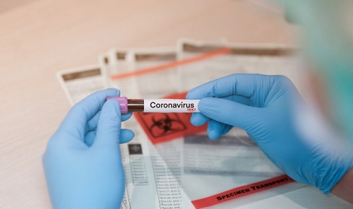 Franca registra 64 curados e total de 139 infectados pela Covid-19