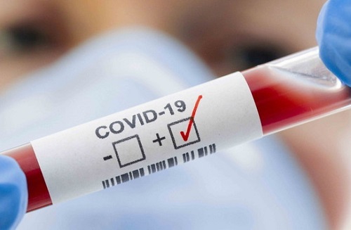 Covid-19: Médicos apontam as variantes em circulação no país