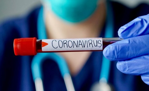 Covid-19: Com mais 8 casos, Franca soma total de 355 infectados e 128 curados