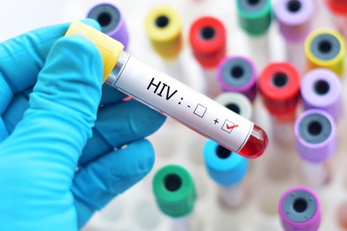 Saúde amplia vacinação contra a covid-19 para pessoas com HIV/AIDS