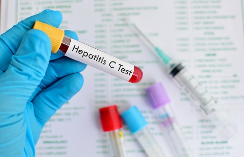Ministério da Saúde: Brasil avança no combate à hepatite C