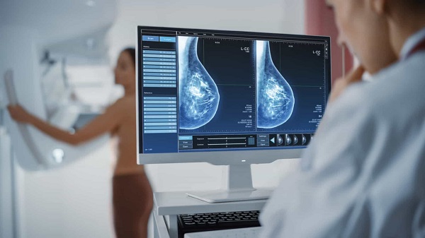 SP conscientiza sobre importância de exame no Dia Nacional da Mamografia