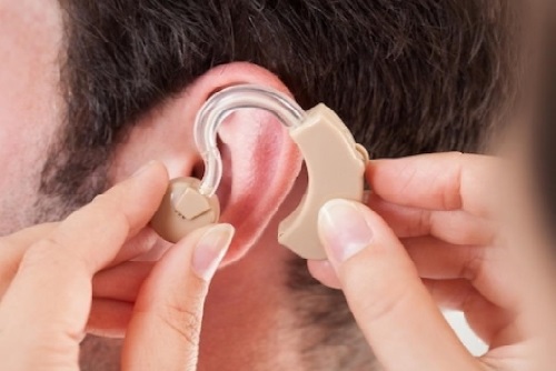 Vereadores destinam mais de R$ 1,8 milhão para compra de aparelhos auditivos