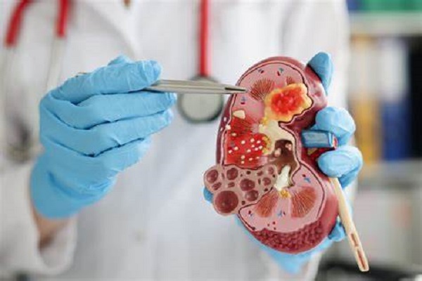 Secretaria da Saúde alerta para importância dos cuidados renais