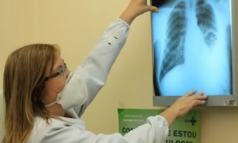 Tuberculose matou 5,8 mil brasileiros em 2022